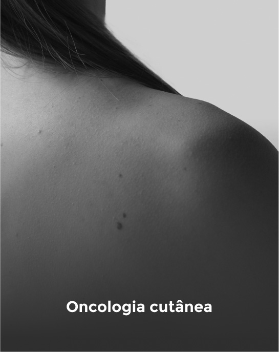 oncologia